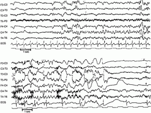 love/hate relationship