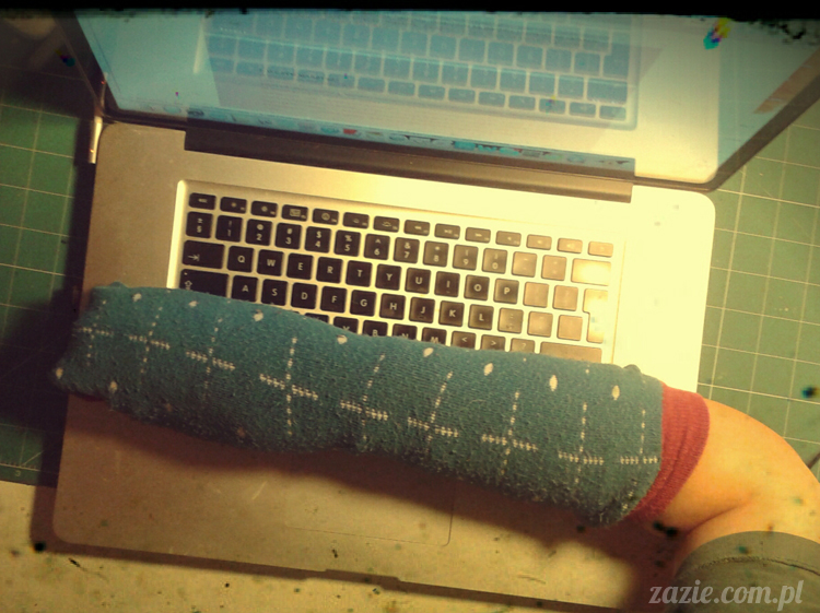 zespół przeciążeniowy nadgarstka łokieć tenisisty golfisty u copywritera zespół przeciążeniowy nadgarstka łokieć tenisisty golfisty u copywritera