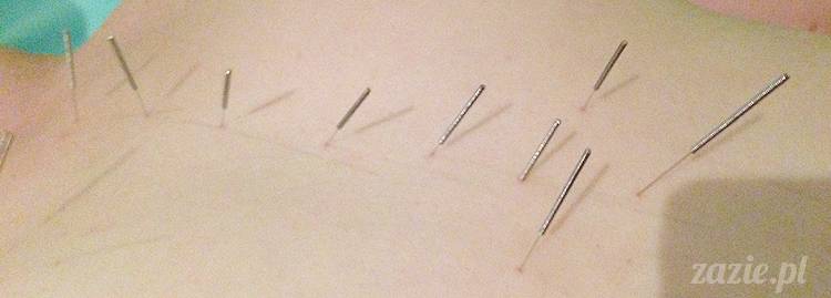 akupunktura, tradycyjna medycyna chińska, chińskie zioła, ziołelecznictwo, Klinika Mistrza Zhang, masaż leczniczy Tui Na, Qi Gong, shifu Zhang Feng Jun