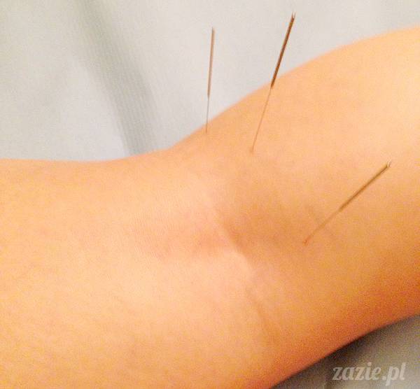 akupunktura, tradycyjna medycyna chińska, chińskie zioła, ziołelecznictwo, Klinika Mistrza Zhang, masaż leczniczy Tui Na, Qi Gong, shifu Zhang Feng Jun