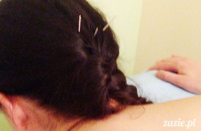 akupunktura, tradycyjna medycyna chińska, chińskie zioła, ziołelecznictwo, Klinika Mistrza Zhang, masaż leczniczy Tui Na, Qi Gong, shifu Zhang Feng Jun