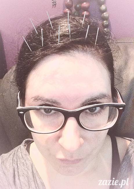 akupunktura, tradycyjna medycyna chińska, chińskie zioła, ziołelecznictwo, Klinika Mistrza Zhang, masaż leczniczy Tui Na, Qi Gong, shifu Zhang Feng Jun