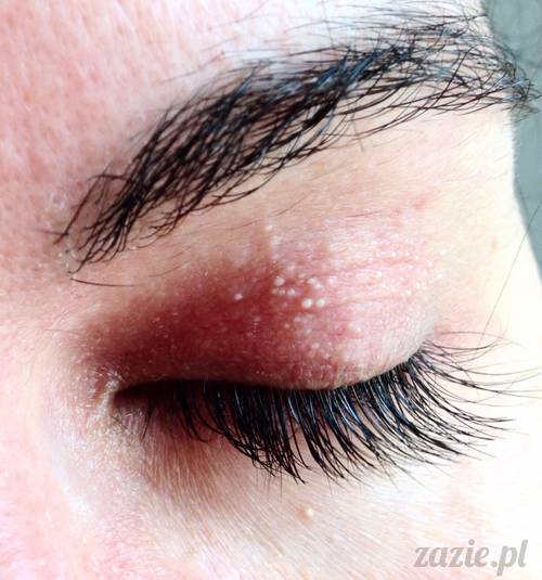 akupunktura, tradycyjna medycyna chińska, chińskie zioła, ziołolecznictwo, Klinika Mistrza Zhang, masaż leczniczy Tui Na, Qi Gong, shifu Zhang Feng Jun