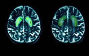 Cześć, jestem Olga. mam 37 lat i jestem… uzależniona.